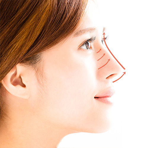 limclinic-and-surgery-nose-threadlift